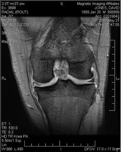 mri.jpg